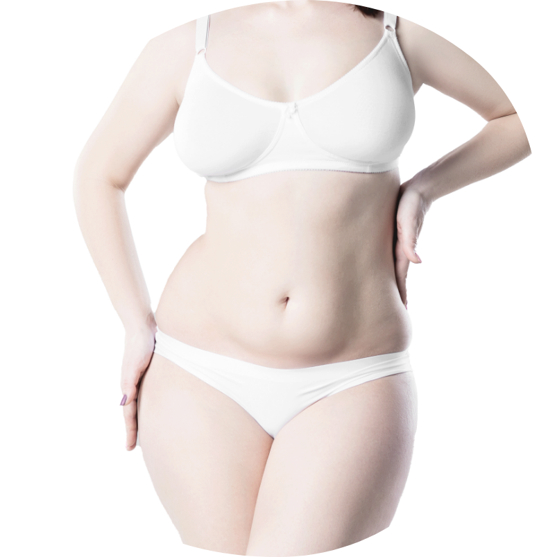 poseg abdominoplastike opravim